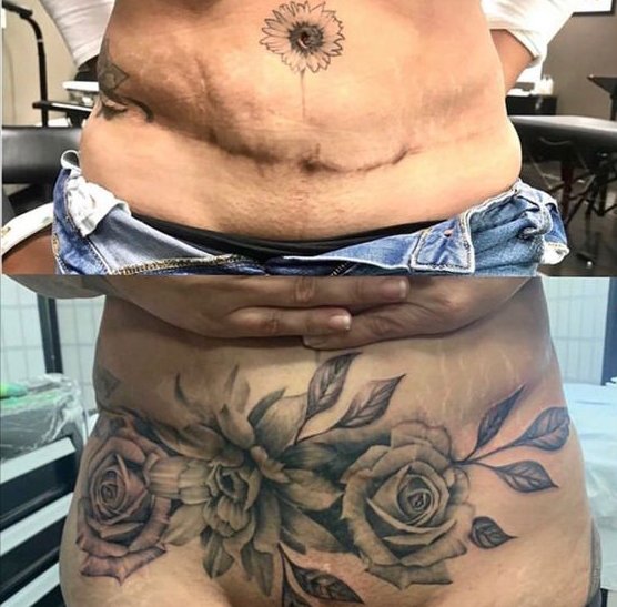 10 Flowers Mommy Makeover Tattoo