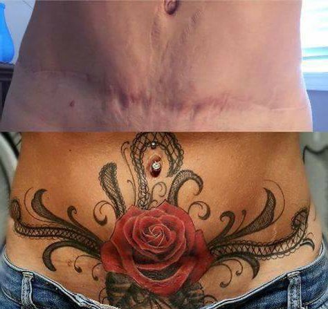 3 Red Rose Tattoo Mommy Makeover Tattoo 1