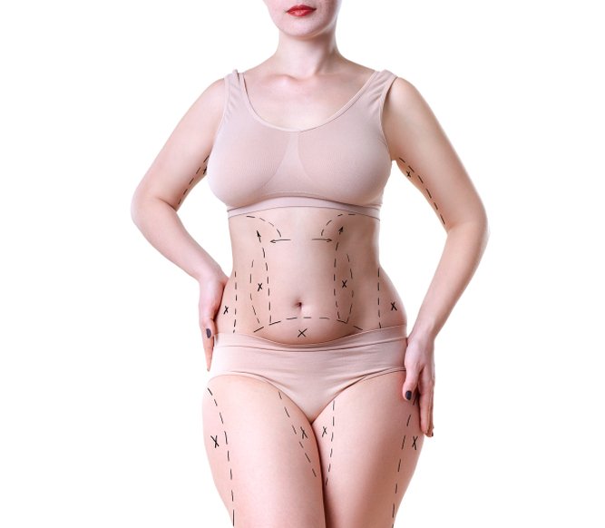 Plus Size Tummy Tuck, try to feel comfortable in my own skin. :  r/PlasticSurgery